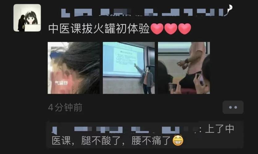 课上拔火罐?“头发变多”的秘笈来了!