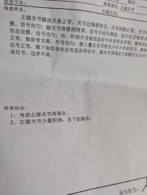 奥孔古因左膝炎症至少缺席四场比赛 一周后重新评估