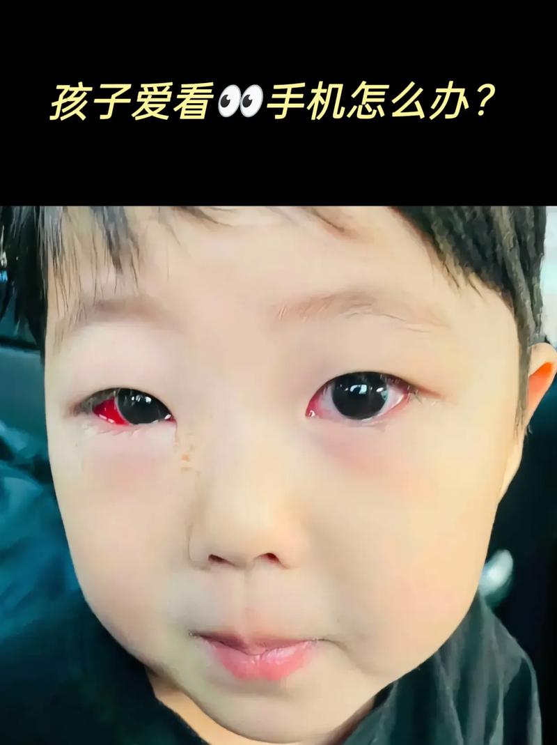6岁男孩视力骤降至0.3!罪魁祸首不是手机而是它,家家都有